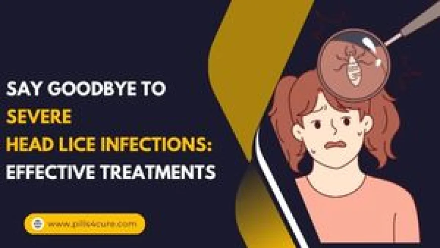 Head Lice Infection: Causes, Symptoms, and Treatment