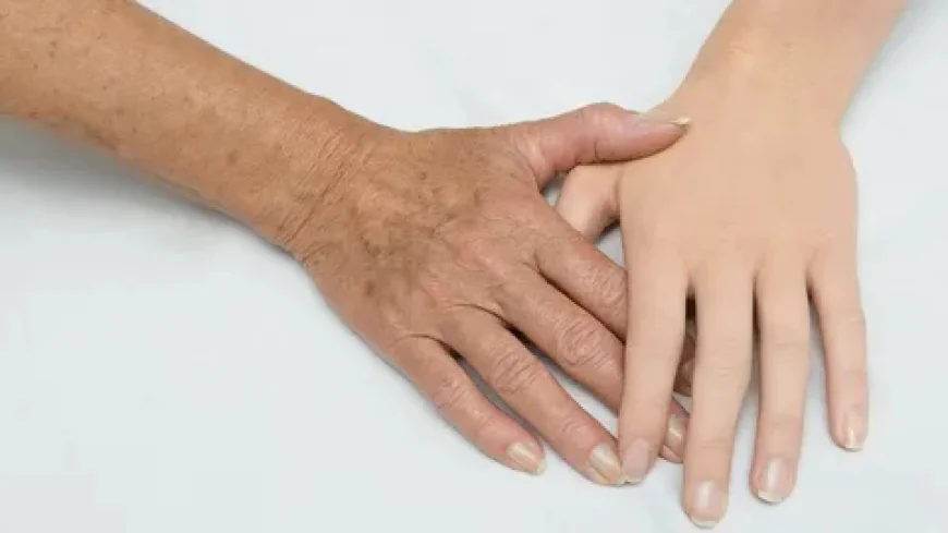 What Results Can You Expect from CO2 Hand Rejuvenation?