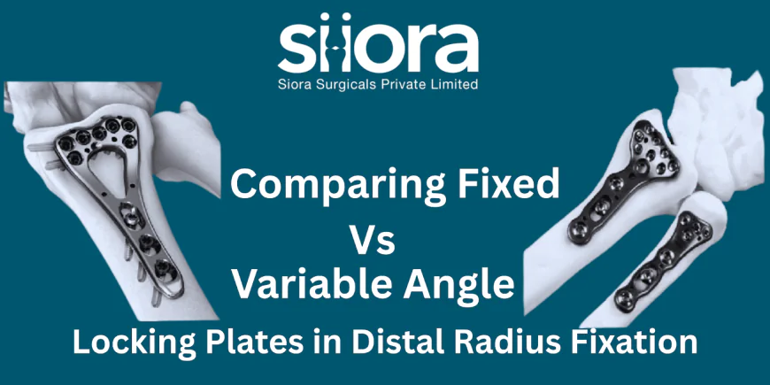 Comparing Fixed vs Variable Angle Locking Plates in Distal Radius Fixation