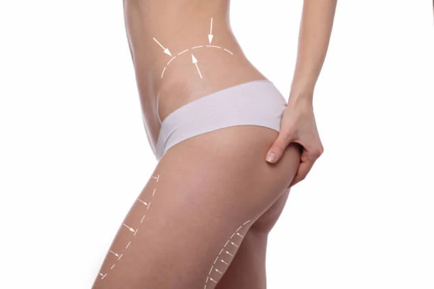 Affordable Thigh Lift in Riyadh Clinics