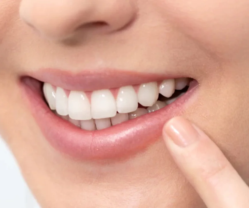 Smile Restoration Made Easy: A Complete Guide to Dental Bridges in Santa Maria