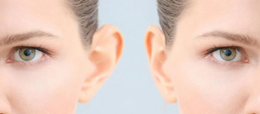 What Affects the Ear Reshaping Cost in Islamabad and How to Budget It