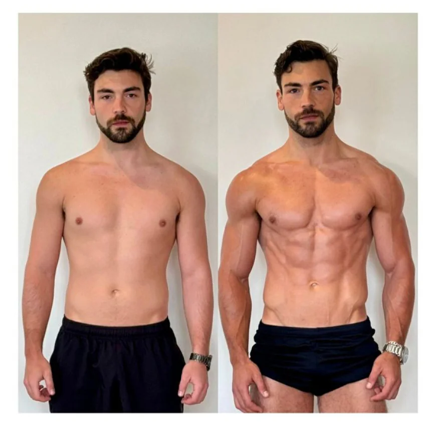 Top Questions to Ask Your Gynecomastia Surgeon