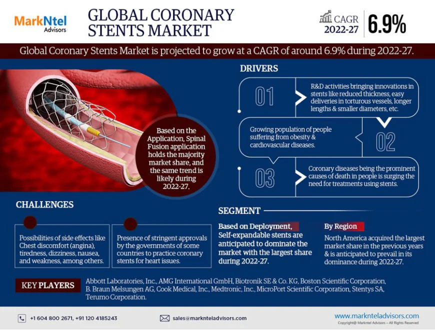Coronary Stents Market Growth Report | Trends & Insights 2022-27