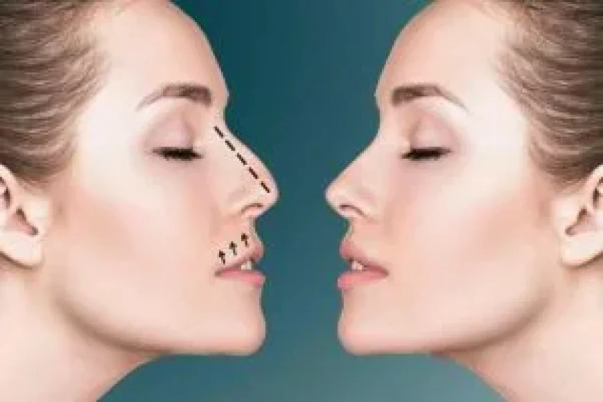 الفرق بين عملية تجميل الأنف الجراحية والغير جراحية