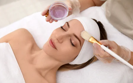 Are Chemical Peels Better Than Facials in Islamabad?