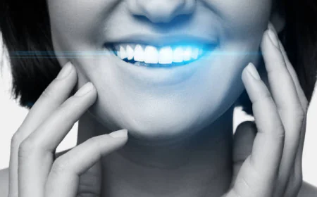 Achieve a Radiant Smile with Pain-Free Teeth Whitening Carindale