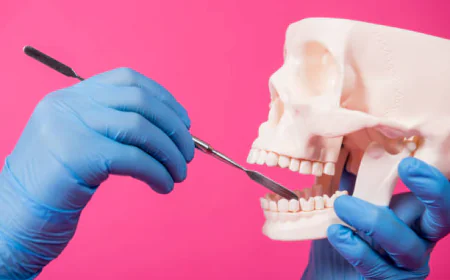 Understanding Bone Grafting in Stockton: What You Need to Know