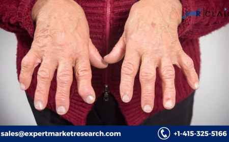 Psoriatic Arthritis Treatment Market: Market Expansion and Future Outlook (2034)