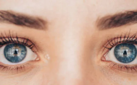 Common Myths About Eyelid Surgery in Riyadh