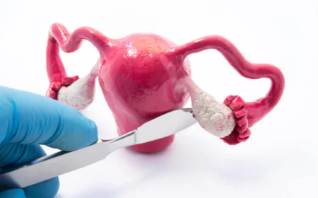 Expert Care for Ovarian Cyst Treatment in South Delhi