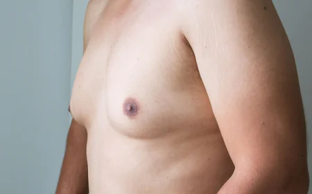 How to Budget for Gynecomastia Surgery Without Breaking the Bank