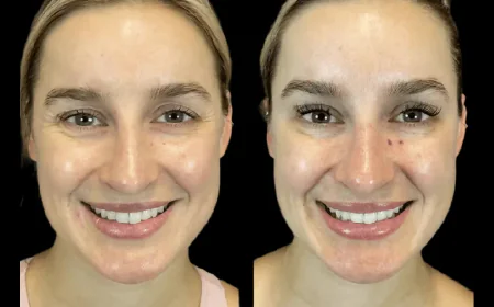 Best Plastic Surgeons in Dubai Reveal What Makes a Perfect Botox Candidate