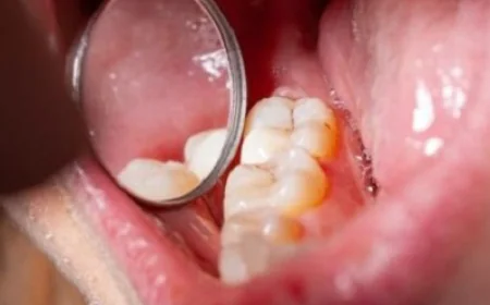 Can Dental Tooth Fillings Be Done Without Anesthesia?