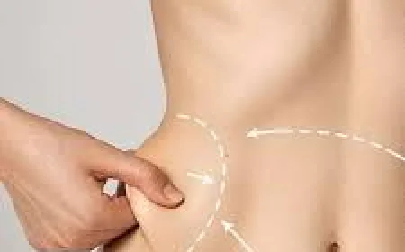 Abdominoplasty in Islamabad – Transform Your Midsection with Confidence
