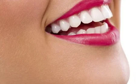 Teeth Whitening for Sensitive Gums