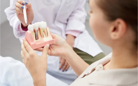 What Is the Success Rate of Dental Implants? Facts You Need to Know