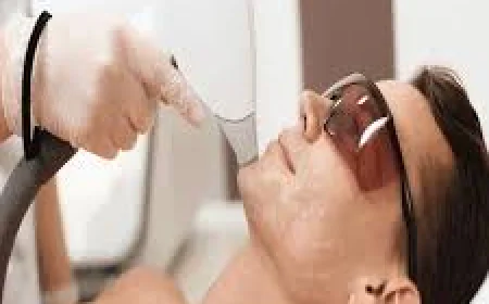 Laser Hair Removal in Islamabad – The Permanent Solution to Unwanted Hair