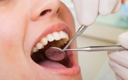 Zirconia Crown Benefits in Cosmetic Dentistry