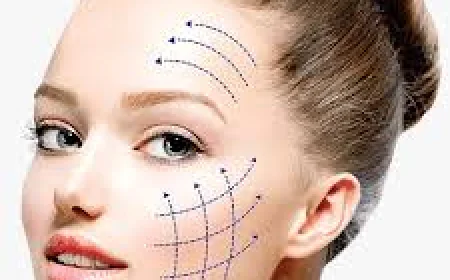 Choosing the Right Clinic for Thread Lift in Islamabad