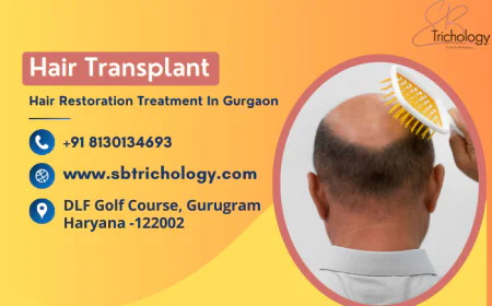 Why is a Hair Transplant the Best Procedure for Hair Restoration?