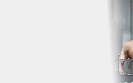 Hair Transplant: What to Expect Before, During, and After