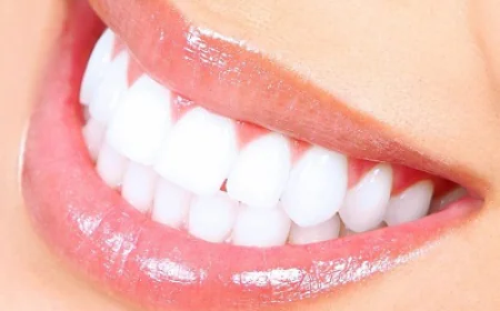 Dental Clinic Near Me Offering Dental Bonding