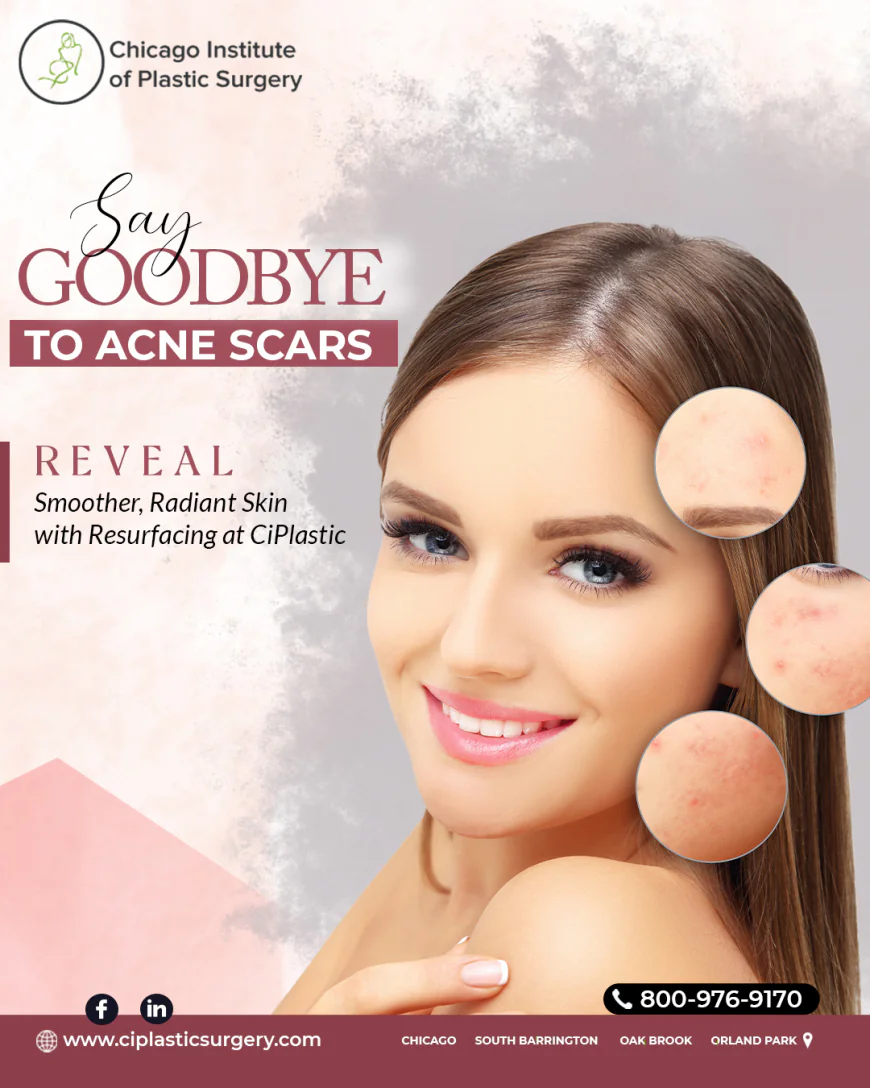 Transform Your Look with Liposuction Plastic Surgery in Chicago