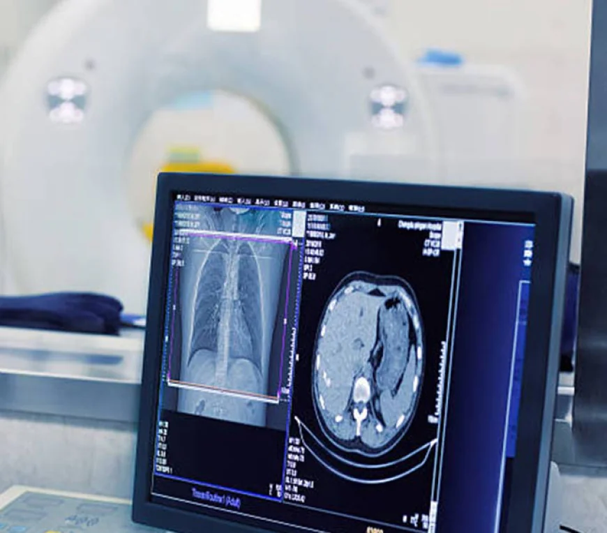 Enhance Diagnostic Precision with the Right X-ray Machine for Your Medical Office
