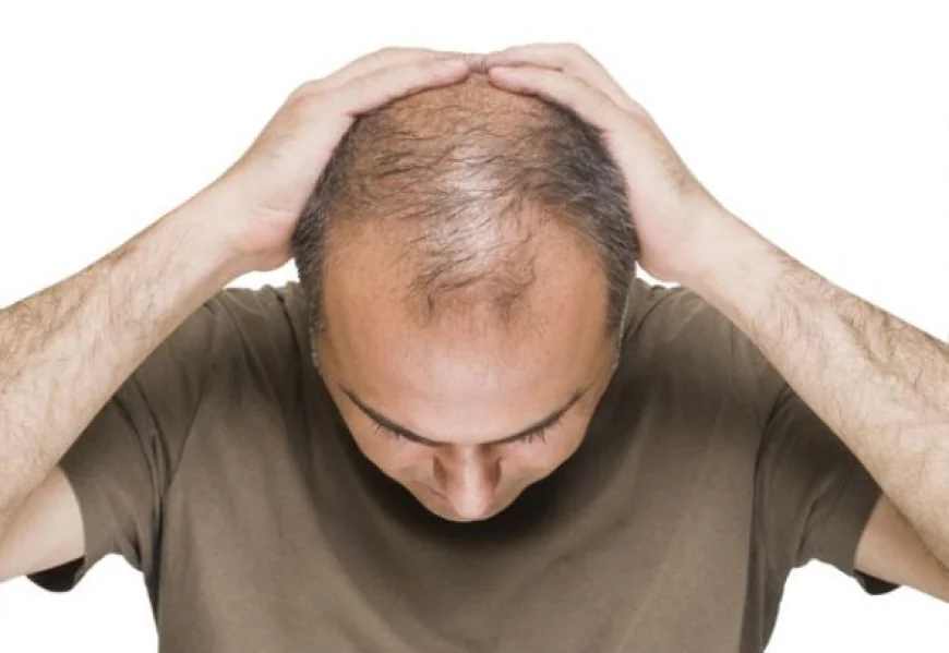 دليلك الشامل لزراعة الشعر في الرياض