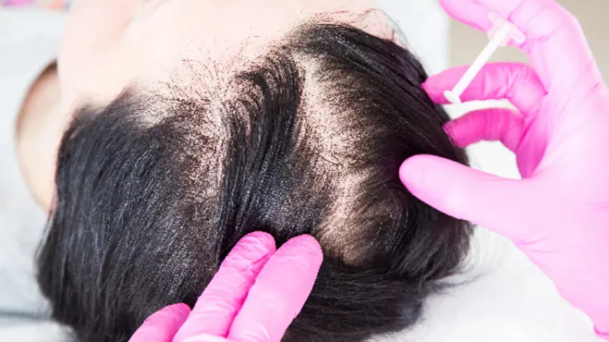 How Much Does Exosome Hair Therapy Cost in Islamabad?