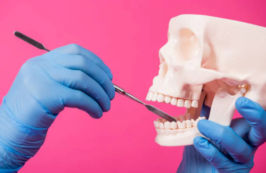 Understanding Bone Grafting in Stockton: What You Need to Know