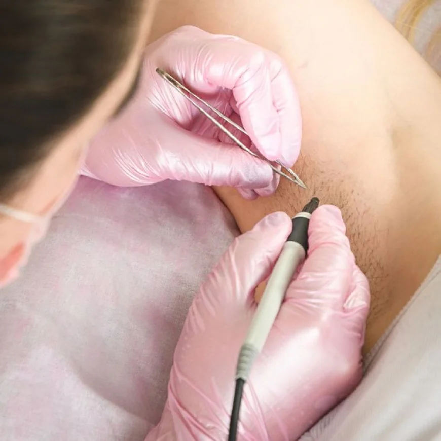 Can I Shave or Wax Between Electrolysis Sessions?