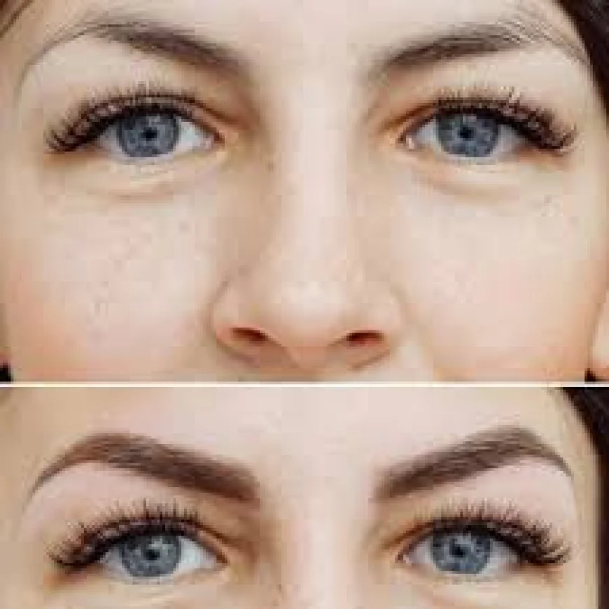 Microblading Treatment in Islamabad – Perfect Brows Made Easy