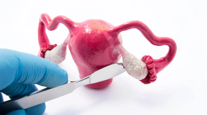 Expert Care for Ovarian Cyst Treatment in South Delhi