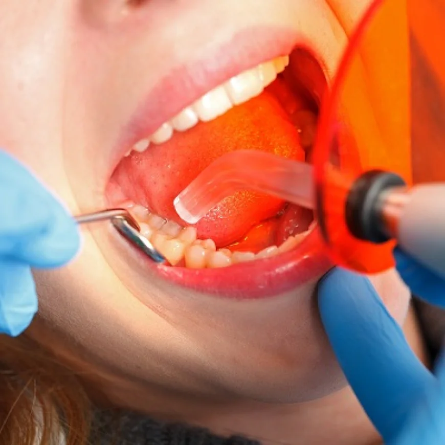 Dental Tooth Filling for Children: What Parents Should Know