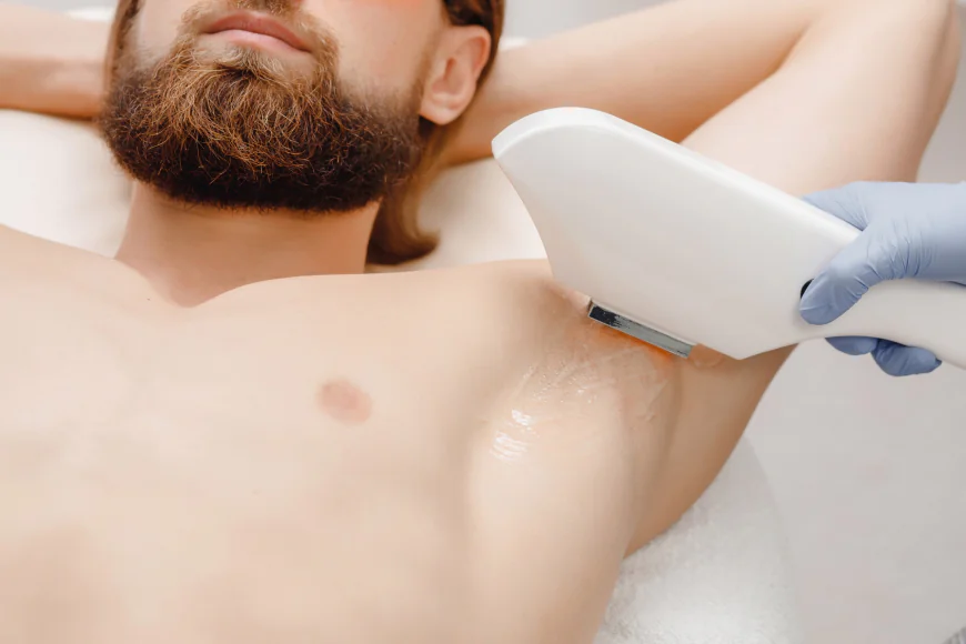 How High Is Male Laser Hair Removal Cost?
