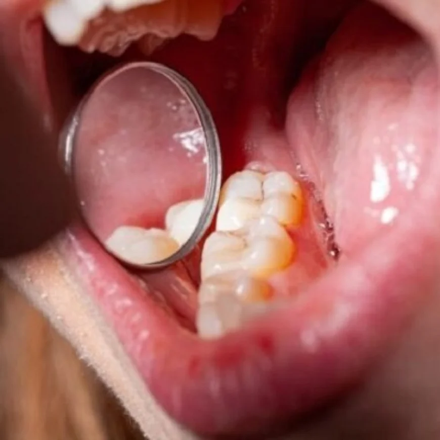 Can Dental Tooth Fillings Be Done Without Anesthesia?