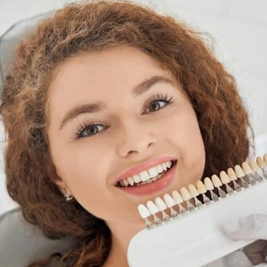 Dental Veneers Care Tips for Beginners