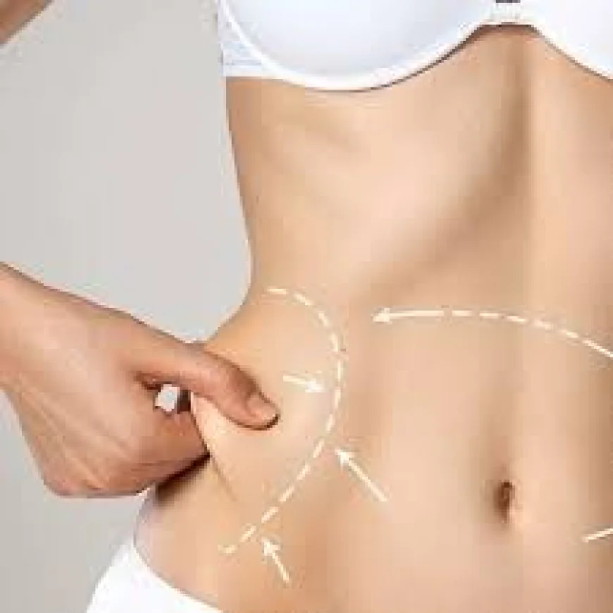 Abdominoplasty in Islamabad – Transform Your Midsection with Confidence