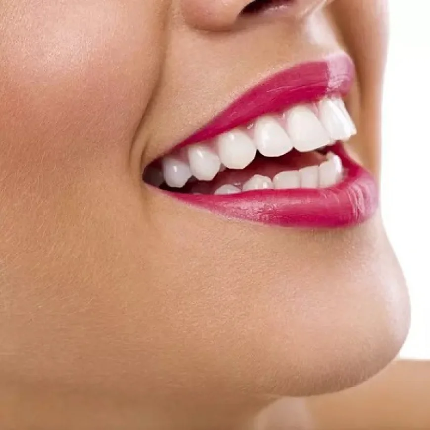 Teeth Whitening for Sensitive Gums