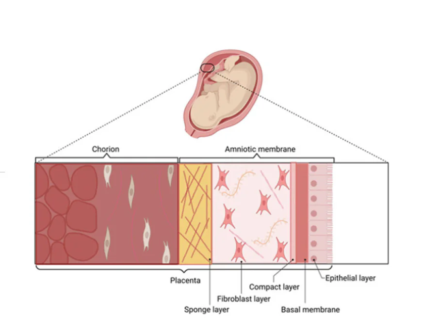 8 Key Reasons Why Clinicians Prefer Helicoll for Advanced Wound Management