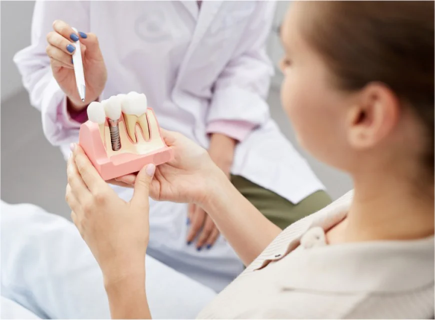 What Is the Success Rate of Dental Implants? Facts You Need to Know