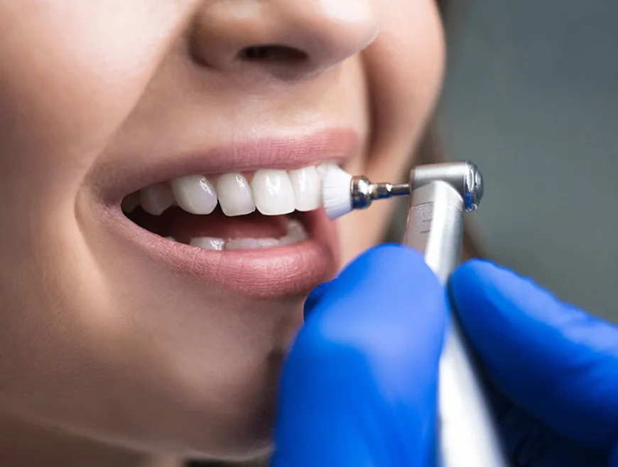 Is Dental Cleaning Necessary If I Brush Daily?