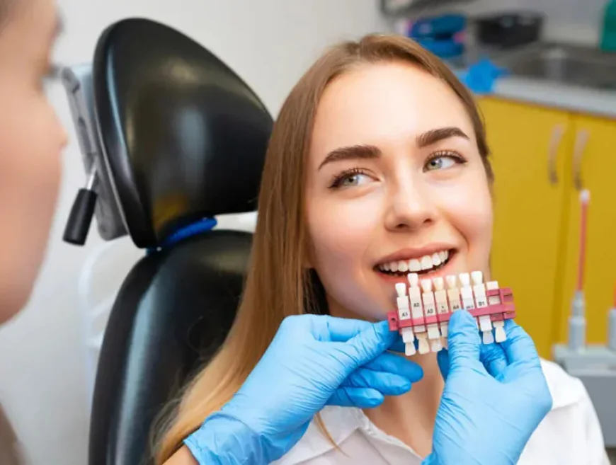 Are Porcelain Veneers Worth It? Facts You Need to Know