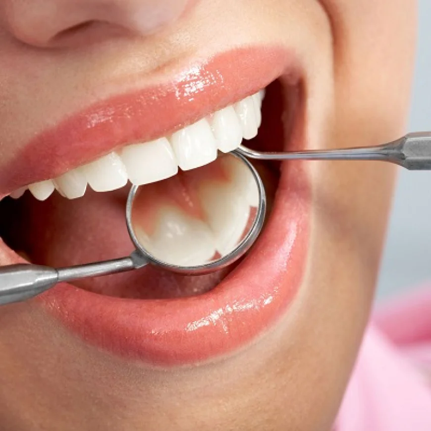 How Tooth Fillings Improve Your Smile
