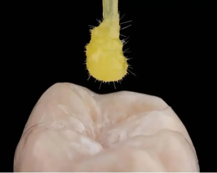 Smile Transformations with Porcelain Veneers in New York