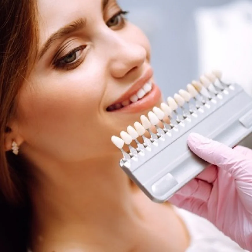 Are E-Max Veneers Safe for Kids?