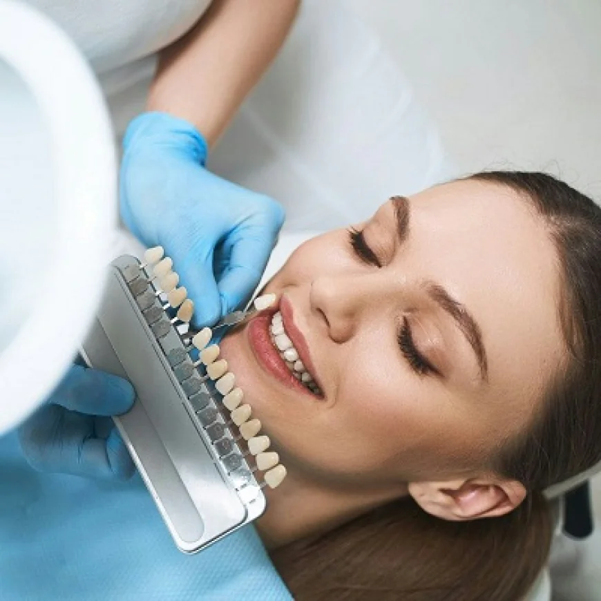 Can E-Max Veneers Crack from Pressure?