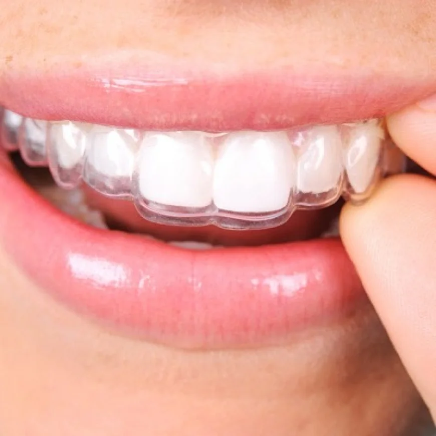 Orthodontists’ Advice for Teen Smile Confidence